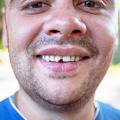 a man with a chipped tooth smiling